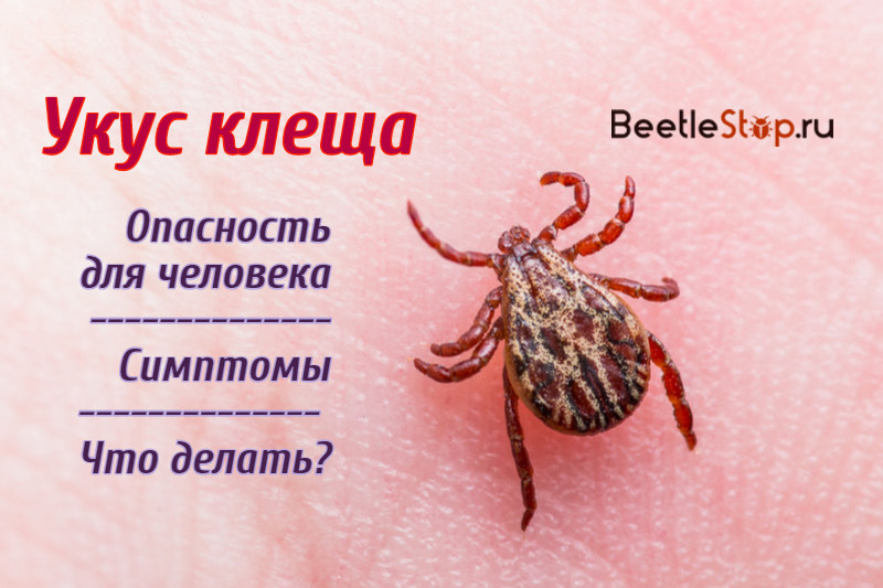 Tick ​​bite